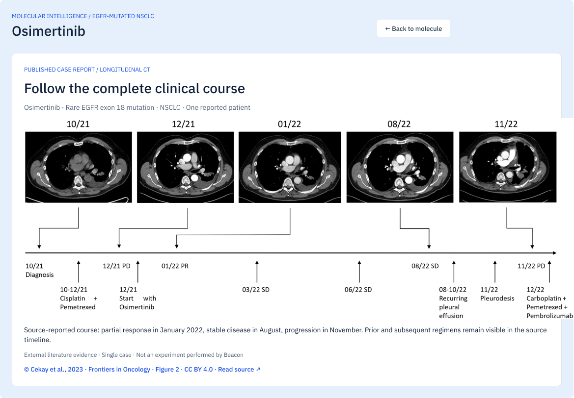 Beacon clinical timeline for osimertinib showing five dated CT images across 2021 and 2022 aligned to a treatment and response timeline, with source attribution beneath.